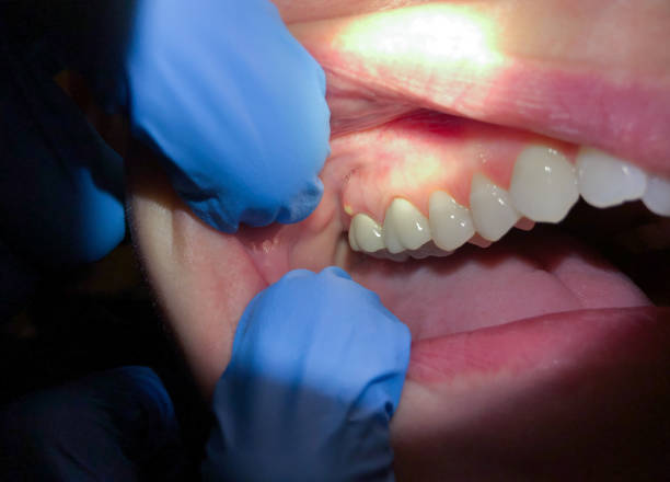 Best Affordable Emergency Dental Care  in Bacliff, TX